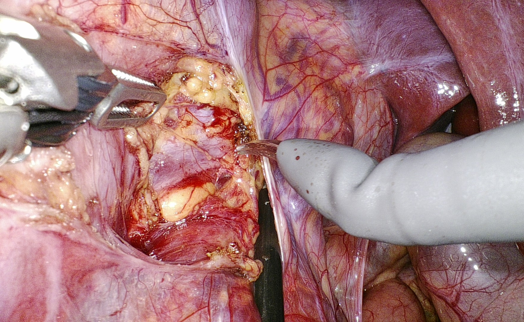 智能图像降噪算法